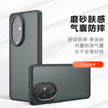�羳������ҫ200Pro�ֻ������ĥɰhonorX9B��ˤ������Magic6Lite