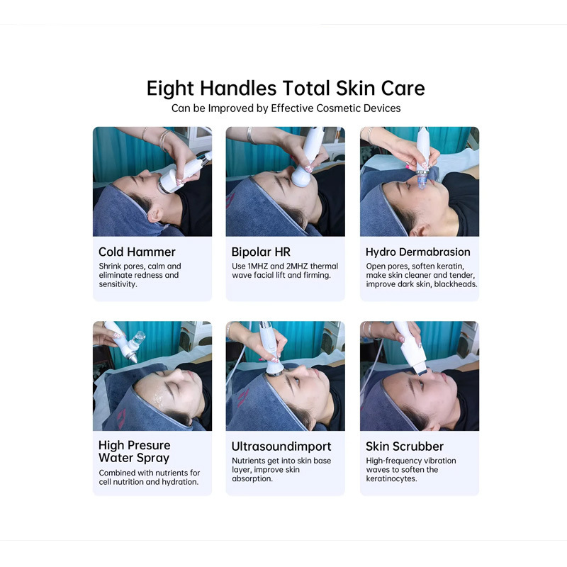 wface 6-in-1 Skin Hydra: Camera, Oxygen, Salon/SPA Gear|undefined
