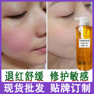 �ʲ��ޏ�ԭҺ �������oȥ�tѪ�z�������м�������|���澏���AҺ