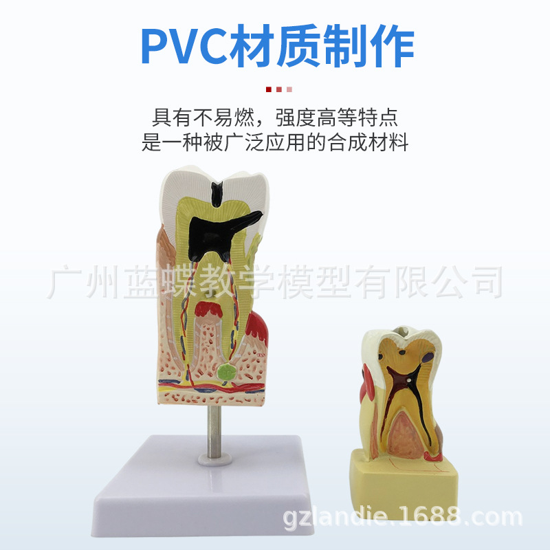 ���ƿ�ǻ�ı�ȣ�ݷֽ�ģ�� ����������ʾȣ�ݷ�չ���� ҽ����ͨ