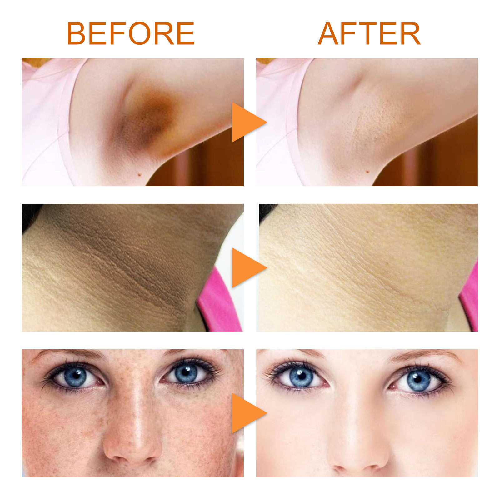 Vitamin C Smoothing Soap For Brightening And Moisturising Skin_voghion.com