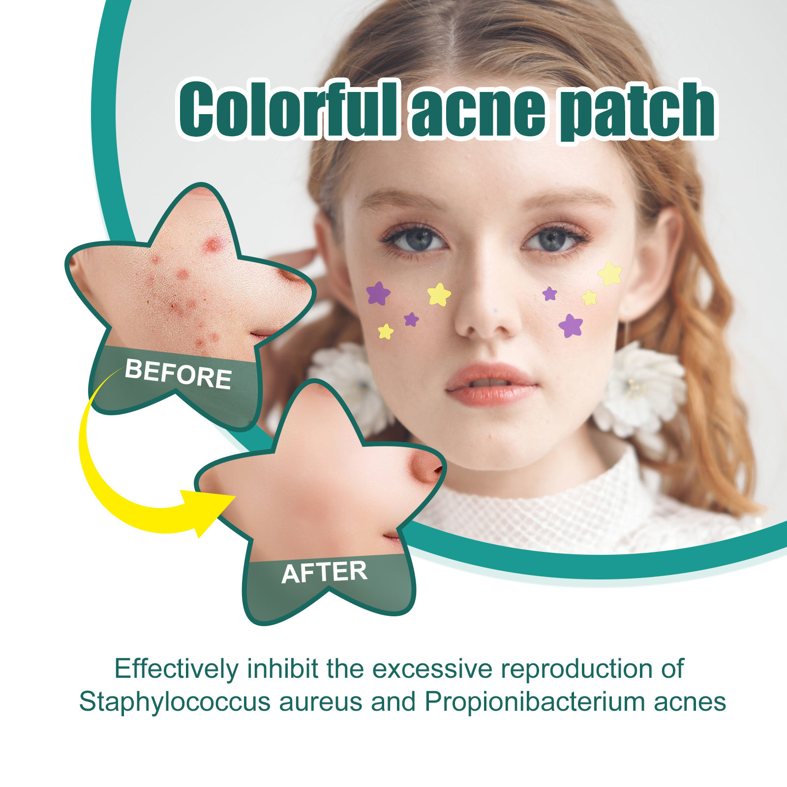 Star shaped patch for lightening spots, marks, cleaning, closing, covering, and repairing acne patches_voghion.com