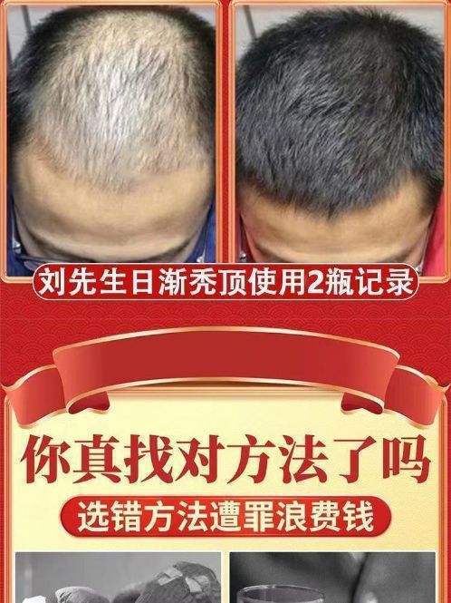 PG电子网址头皮微生态大会在广州举办引领头皮健康新时代