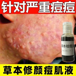 �ݱ�����Һ����Aȥ�]�ڷ۴̵�����ӡ���̶�ӡ�ޏ;��AԭҺ