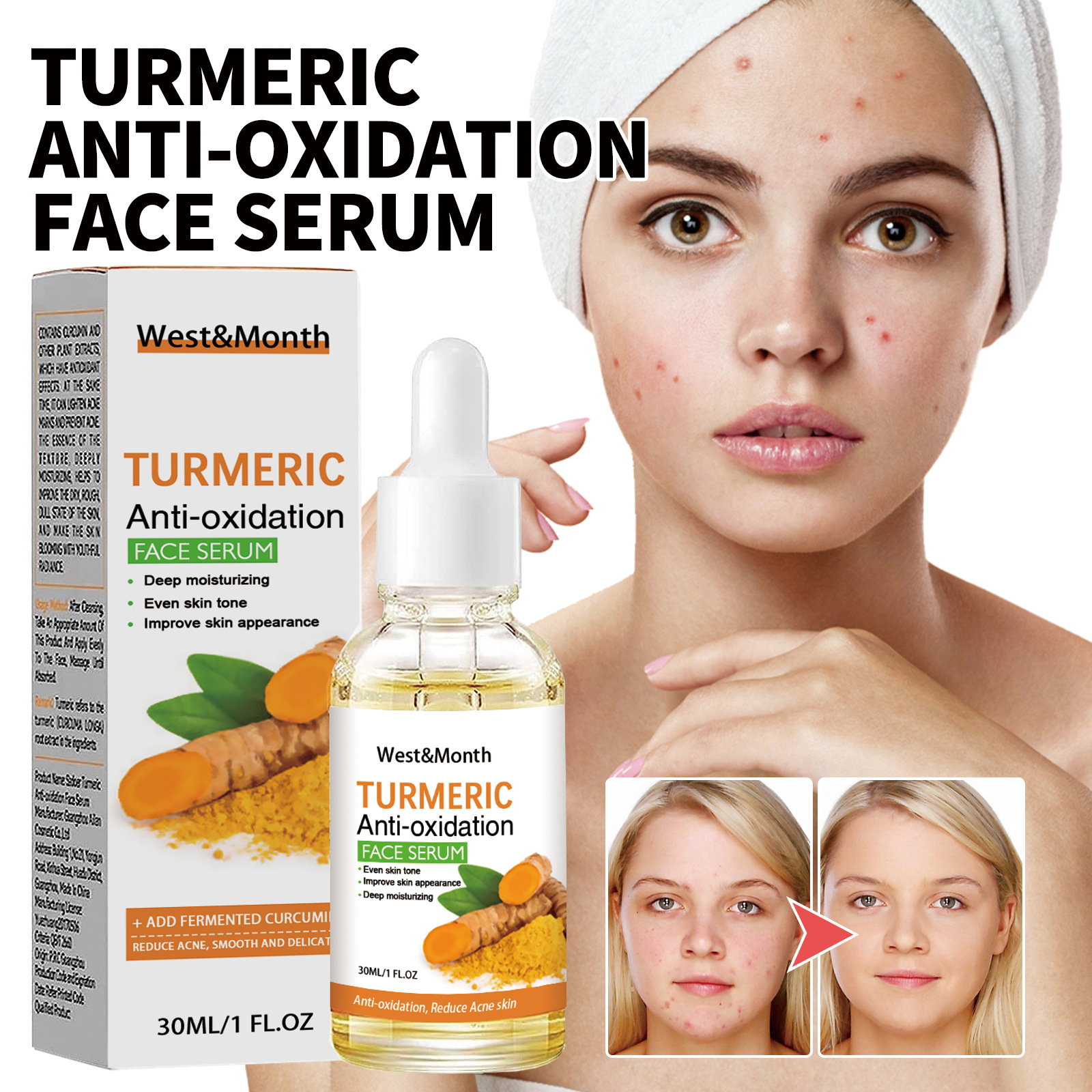 West & Month turmeric facial essence hydrating moisturizing fading spots acne marks brightening moisturizing skin essence