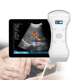 2 年保修 Ultrasound 3 in 1 便携式无线Doppler床旁超声192掌超