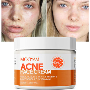 Cross-Border Acne Cream Acne Cream Acne Removal Acne Lightening Acne Marks Closed Mouth Repair Acne Cream Genuine