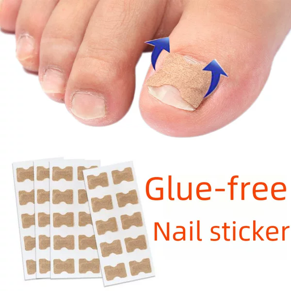 10 Glue-Free Nail Stickers, Ingrown Nail Stickers, Double-Sided Adhesive Strips, Nail Groove Corrector, Pull-Up Stickers, Ingrown Toenail Pedicure Tools