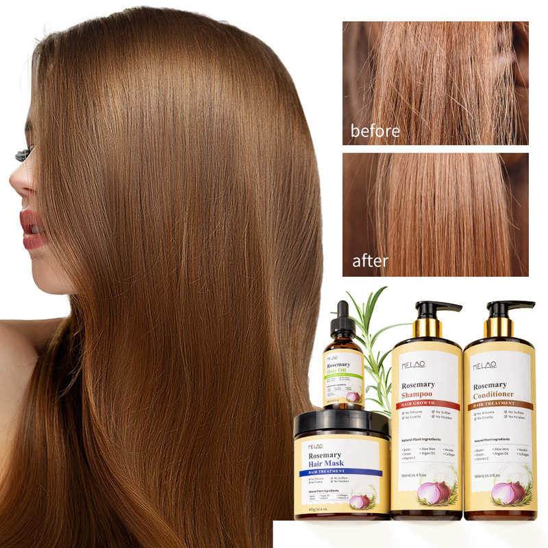 クロスボーダー MELAO 新製品ローズマリーオニオンシャンプーエッセンシャルオイルヘアコンディショナー脱落濃密エッセンスヘアマスク|undefined