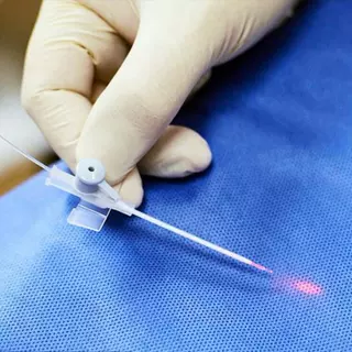 定制 石英光纤 能量光纤光缆 医用光纤 钬激光纤 碎石光纤