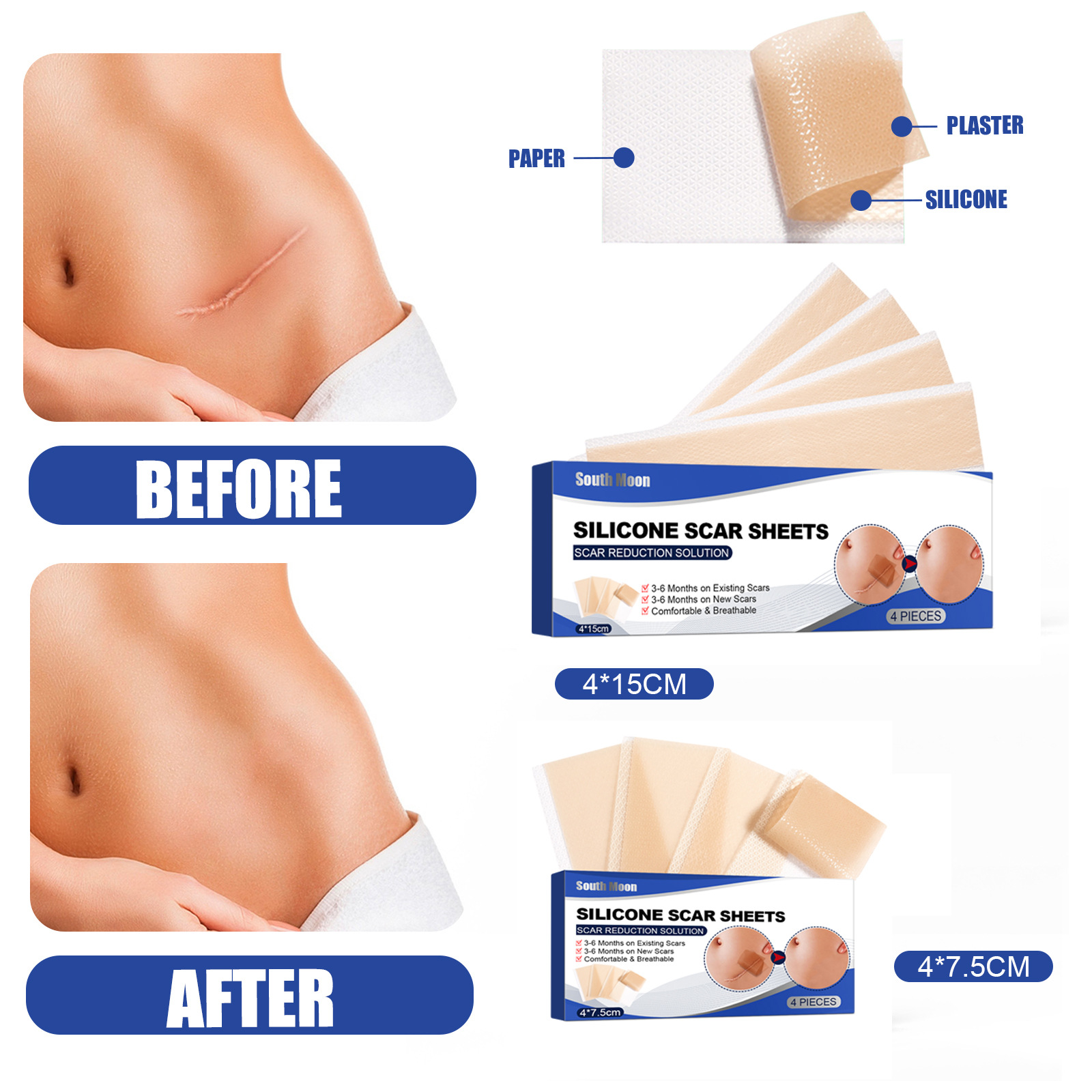 South Moon Self-adhesive Silicone Scar Patch for Repair of Hot Burning Scar Smoothing Skin and Skin Wound Care Patch