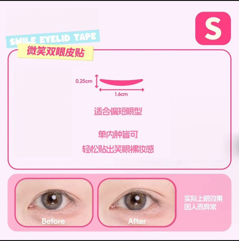 ティヨン泉のほほえみの二重まぶたはステルスを貼って長く持続します。|undefined