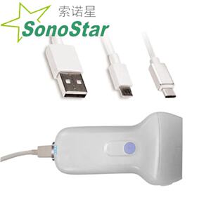 ���Z��Sonostar �S��ֱ�N ��ꇜ\��ϵ�Пo������B��̽�^ ԃ�Ά��r