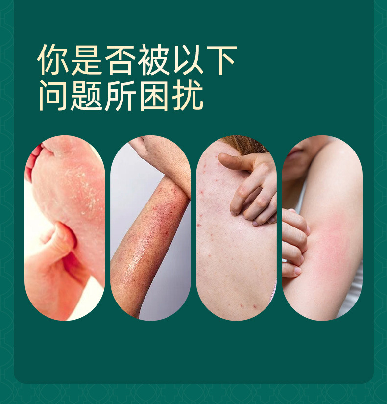 Duba Yufu Ointment Herbal Skin Care Cream External Use 20g Box quality and texture
