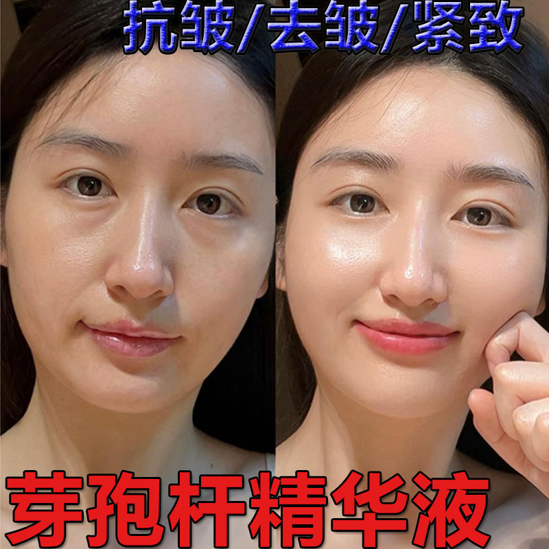 塗布型肉毒菌エキス 引き締め・シワ改善・アンチエイジング・保湿・美容室専用美容液|undefined