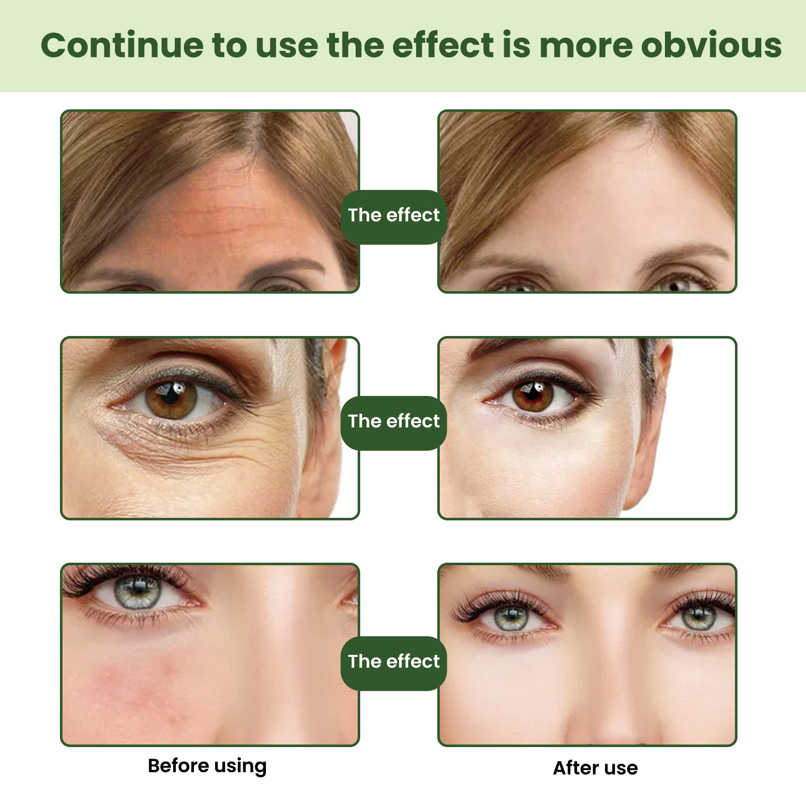 EELHOE Ceramide Firming nutre profundamente as rugas, hidrata e firma a essência da pele_voghion.com