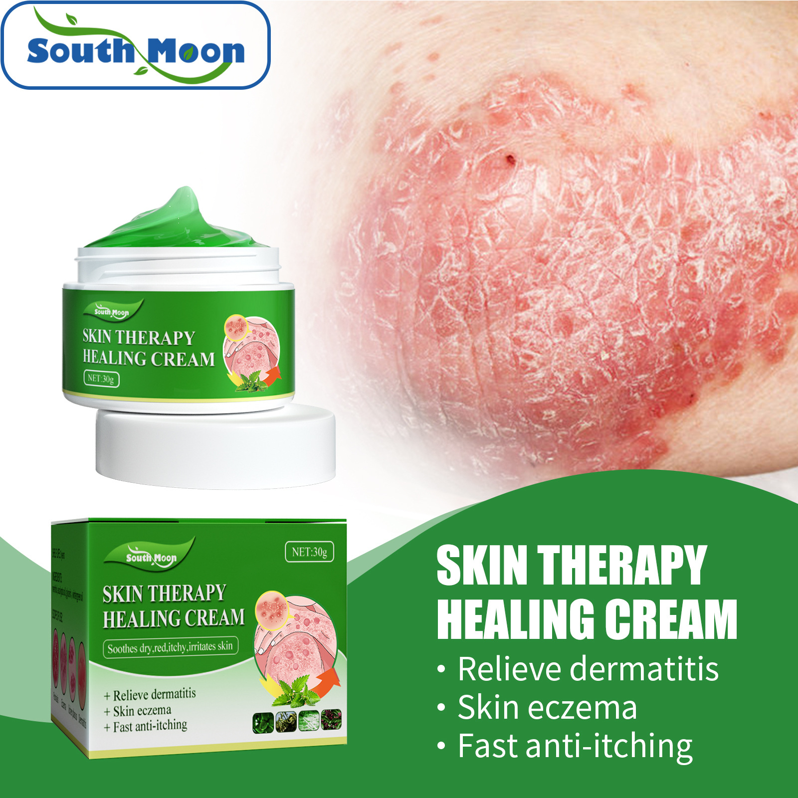 South Moon Anti-Itching Ointment for Wet Blisters, Relieves Itching, Sweat Blisters, Feishizhen Prickly Heat External Ointment_voghion.com