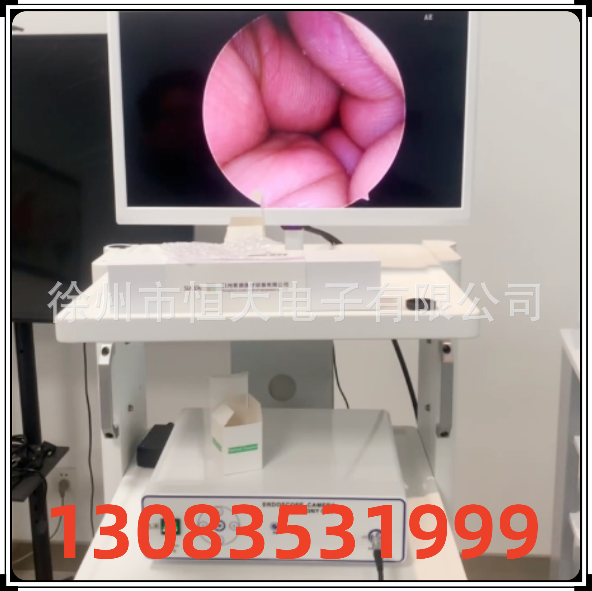 国产腹腔镜 宫腔镜 纤维支气管镜鼻咽喉镜配套高清内窥镜摄像系统