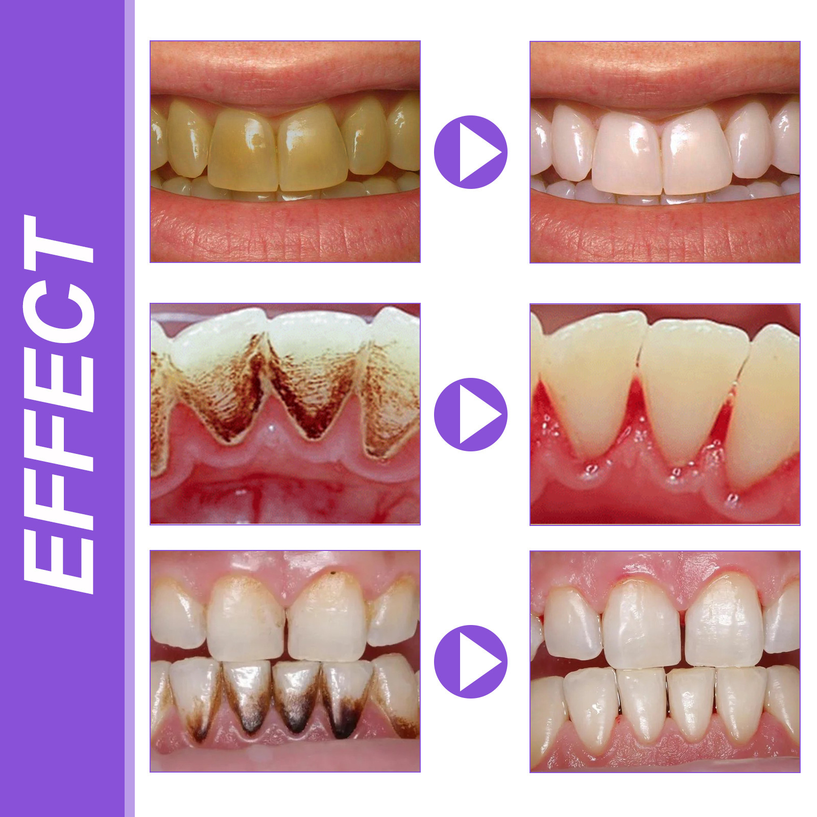 EELHOE V34 dentifrice violet répare les dents jaunes et les taches nettoyage buccal haleine fraîche dentifrice blanchissant_voghion.com
