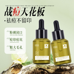 ����AҺƤ�����տsë�״ִ��ޑ��沿�Ք�ë���ӡȥ�]�ڷ۴�