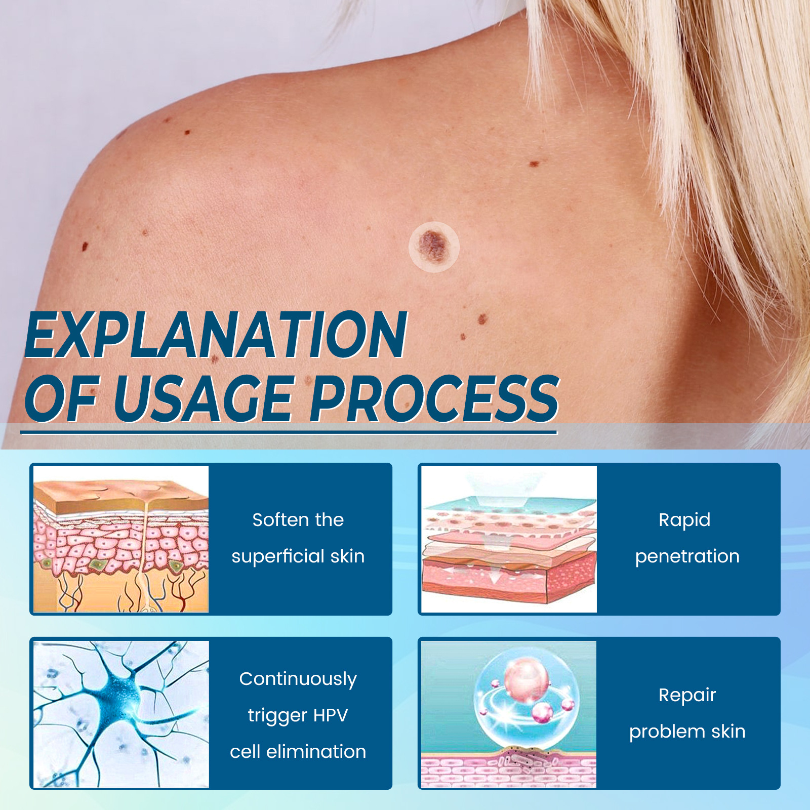 EELHOE Elimineringsplåster för hud Black Memory Curt, Chicken Eyes, Scorpions, Scarless Nevus Cocoon Cleaning and Repair_voghion.com