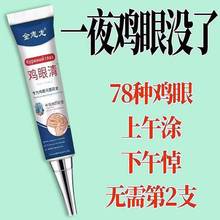 【苗家古方】鸡眼膏鸡眼抑菌液滁脚趾手指鸡眼肉刺顽固除反复生长