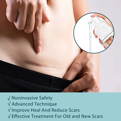 EELHOE Scar Lightening Gel: Post-Surgical, Hypertrophic, Burn & Scald Care&mdash;Fades Scars, Smooths Skin, and Promotes Healing