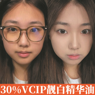 �ձ�30%vcip���A�͏ͺ�ֲ�ﾫ�A���沿��Ч���w���10%vcip���A��