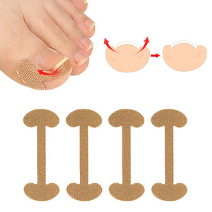Toenail nail groove nail inlay nail foot nail orthosis thumb nail patch quick toenail repair deformation meat bag