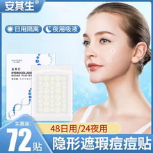 �t�ö����N�o����覶�ӡ�����°ͳ����˹�Ƥ�wɫ�ϊy�[���w�ڶ��N