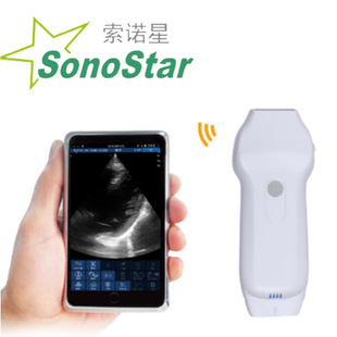 ���Z��Sonostar �S��ֱ�N ���K�\��ϵ�Пo������B��̽�^ ԃ�Ά��r