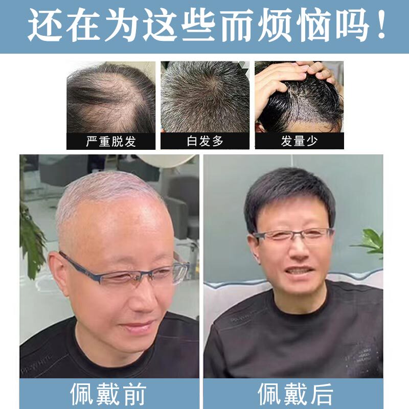 中高年向けの男性用フルヘッドウィッグ、白い光る頭をカバーするショートヘア、本物の髪、リアルでナチュラルな男性用ウィッグ、通気性|undefined