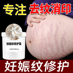 妊娠線修復クリーム、傷跡クリーム、軽い傷跡、美容室専用妊娠線成長線、産後修復引き締めクリーム