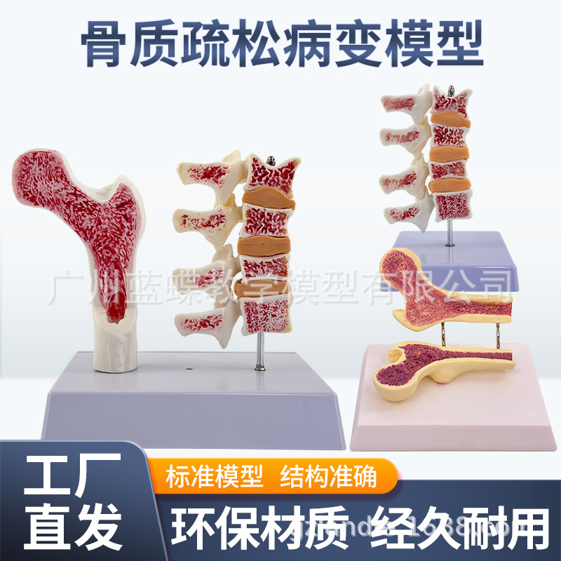 ����ɹǹ������ɽ���ģ���ȹǽ����� ��������걾 ������׵ģ��