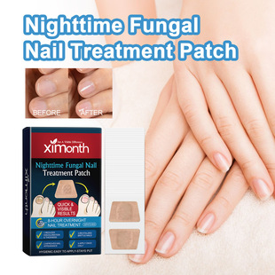 Ximonthָ�����o�NƬ ���o����Ƕ�נ�ָ�������ͻ�ָ�������o���N