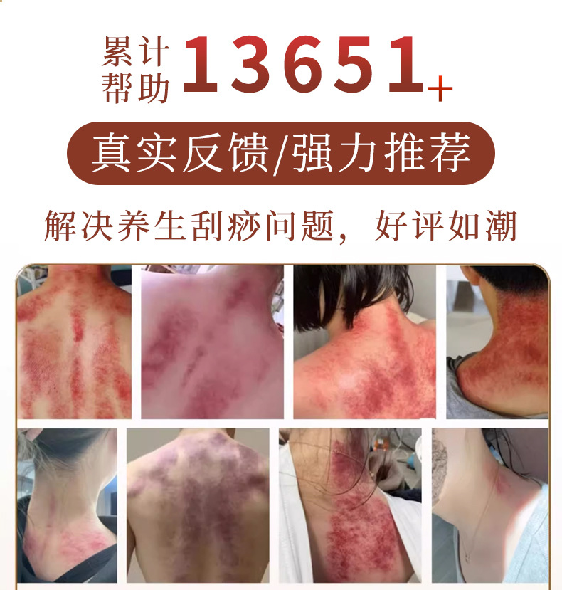Gua Sha Massage Board Full Body Scraping Tool with Mugwort Rose Essential Oil Set for Back Meridian Care overview