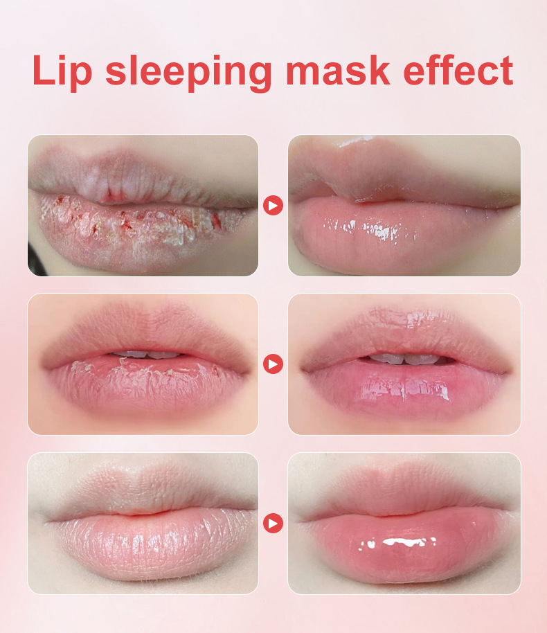Sleep Lip Mask Image 4