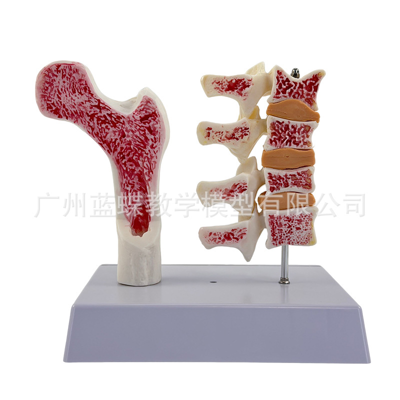 ����ɹǹ������ɽ���ģ���ȹǽ����� ��������걾 ������׵ģ��