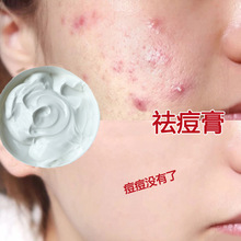 祛痘膏淡化痘印去粉刺闭口修复因子控油收缩毛孔高补水美嫩白面霜
