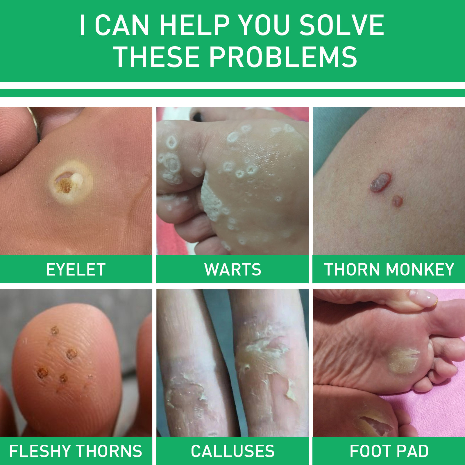 ジェイシング 足用スキンケア液 足の肌をケアし、繊細な足の肌を清潔にするケア液