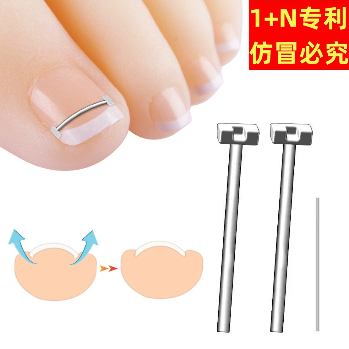 Канавка для ногтей вросший гвоздь никель титановый сплав стальная проволока корректор патч для ногтей палец ногти галстук мясо воспаление стопы