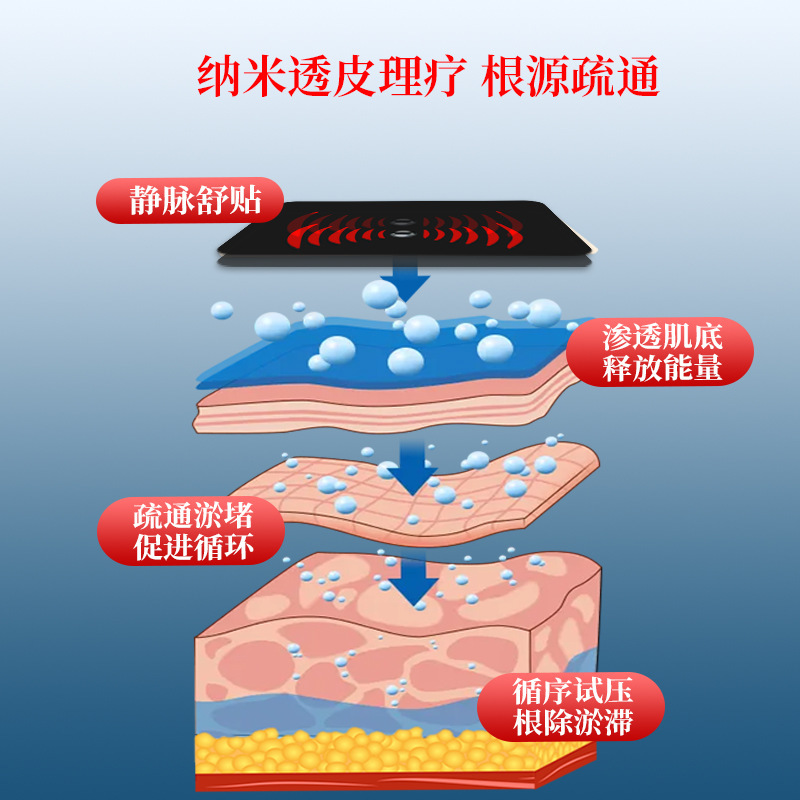 静脉 曲张贴蚯蚓腿血管凸起腿部青筋贴疏通血管缓解下肢酸痛贴膏|undefined