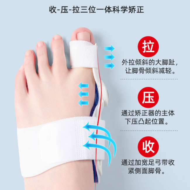 親指外反足指矯正装置昼夜矯正装置親指骨外反母趾矯正インソールつま先セパレーター|undefined
