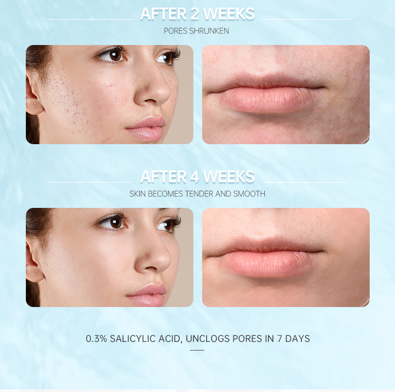 Salicylic Acid Repair Lotion