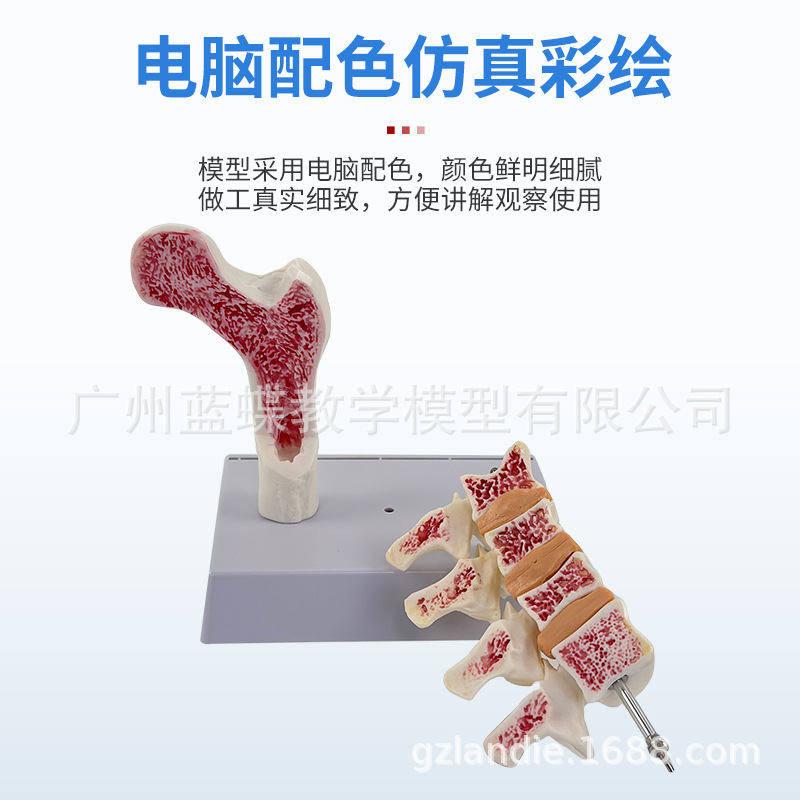 ����ɹǹ������ɽ���ģ���ȹǽ����� ��������걾 ������׵ģ��