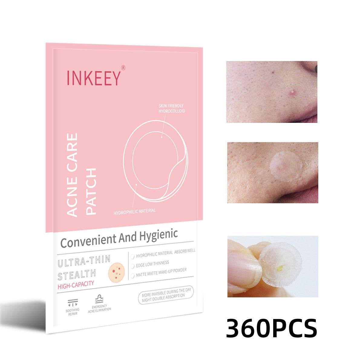 Cruz-frontera exclusiva invisible acné parche corrector estéril facial especial Reparación de primeros auxilios acné parche calmante acné cubierta en stock