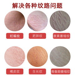 妊娠紋修復精油緊緻淡紋祛肥胖紋孕媽預防產後紋淡化妊娠紋修護膏