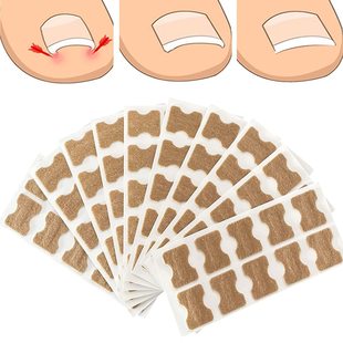 Shoes need in stock glue-free nail stickers toenail nail groove ingrown nail corrector toenail nail patch for manicure