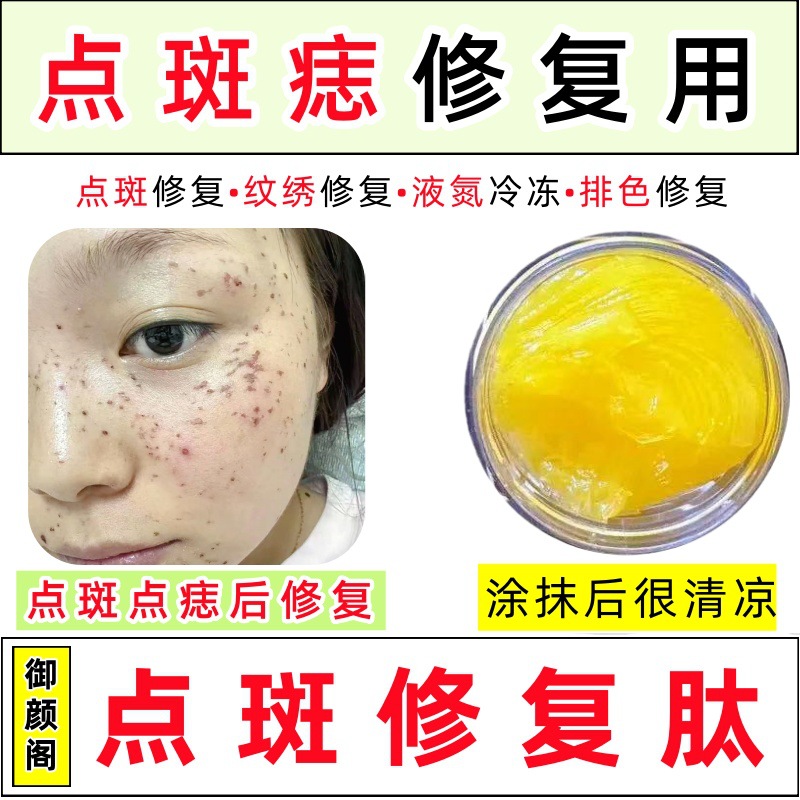 修复肽脸部激光后点痣点斑后淡印红印退红修复膏修护膏皮损修复膏