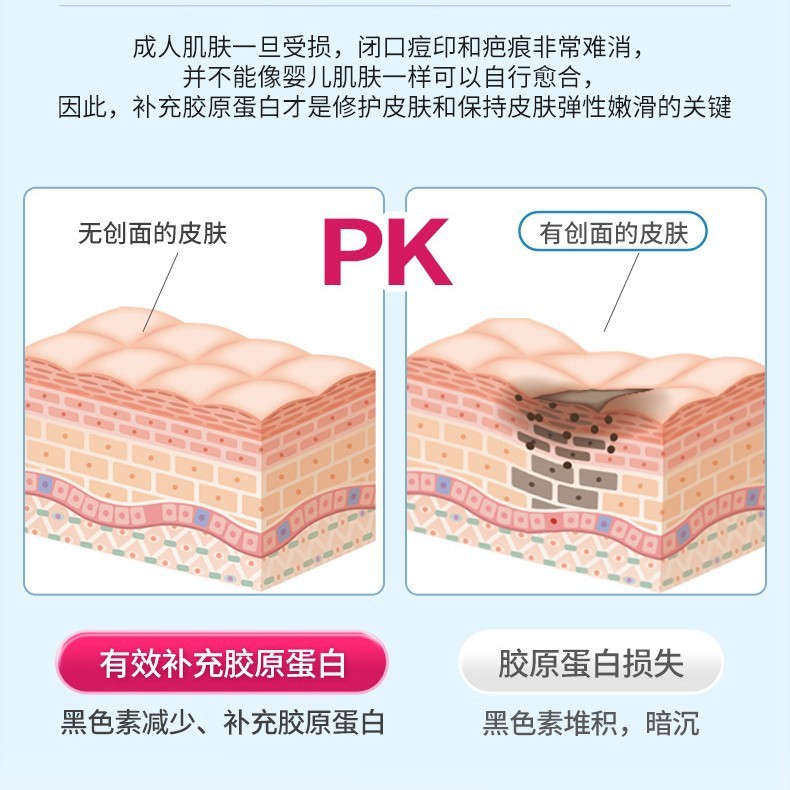 Jingxiutang 再構築コラーゲン修復ジェル創傷擦り傷術後スキンケア修復クリーム医療機器|undefined